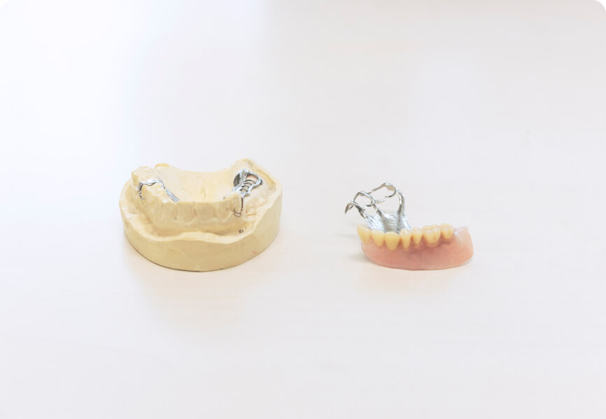 歯科技工の写真